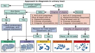 Bladder carcinoma- urinary biomarkers diagnosis and staging | PDF