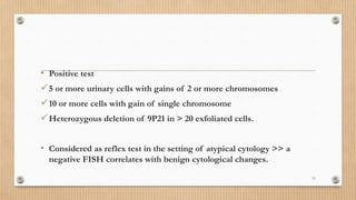 • Positive test
5 or more urinary cells with gains of 2 or more chromosomes
10 or more cells with gain of single chromosome
Heterozygous deletion of 9P21 in > 20 exfoliated cells.
• Considered as reflex test in the setting of atypical cytology >> a
negative FISH correlates with benign cytological changes.
11
 