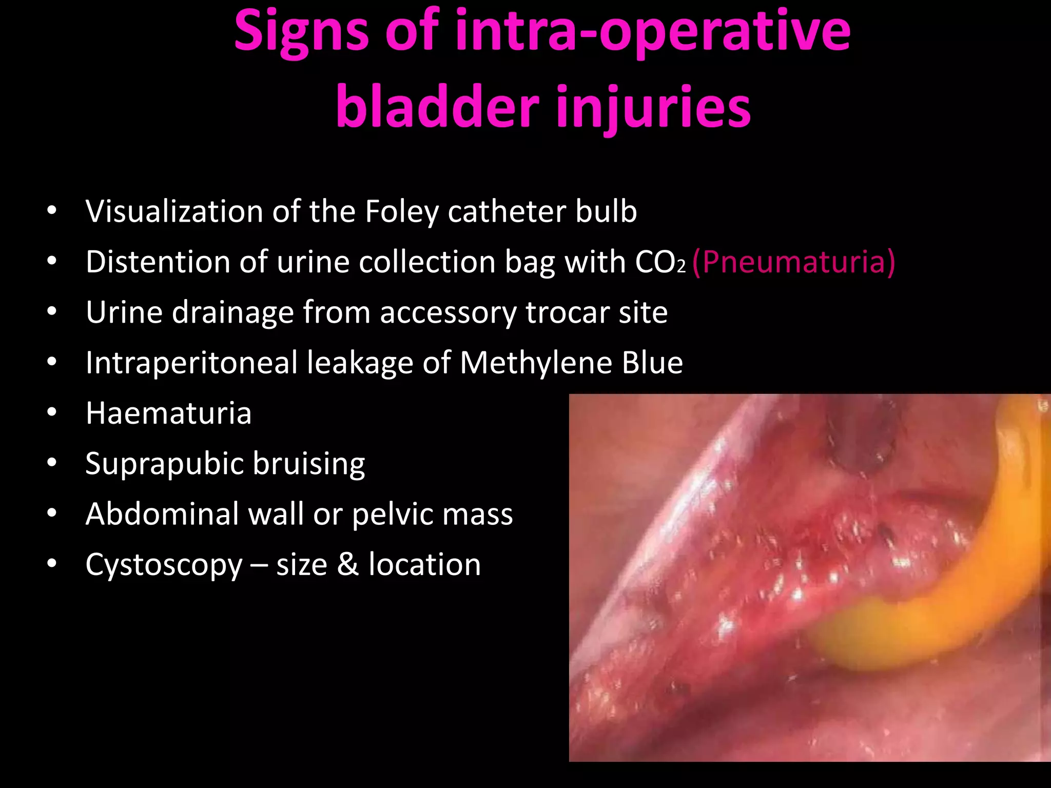 Signs of intra-operative
                  bladder injuries
•   Visualization of the Foley catheter bulb
•   Distention of urine collection bag with CO2 (Pneumaturia)
•   Urine drainage from accessory trocar site
•   Intraperitoneal leakage of Methylene Blue
•   Haematuria
•   Suprapubic bruising
•   Abdominal wall or pelvic mass
•   Cystoscopy – size & location
 