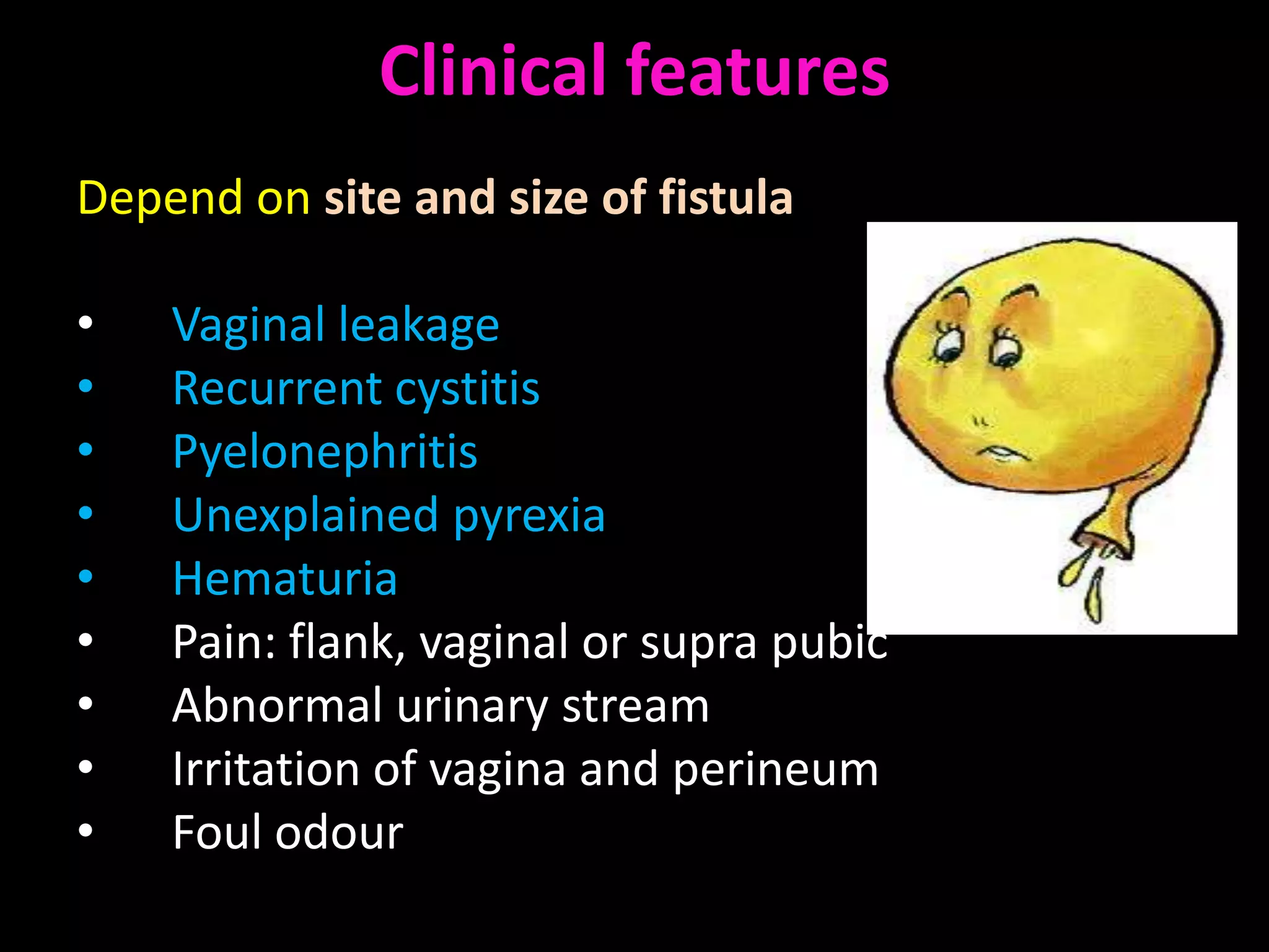 Clinical features
Depend on site and size of fistula

•   Vaginal leakage
•   Recurrent cystitis
•   Pyelonephritis
•   Unexplained pyrexia
•   Hematuria
•   Pain: flank, vaginal or supra pubic
•   Abnormal urinary stream
•   Irritation of vagina and perineum
•   Foul odour
 