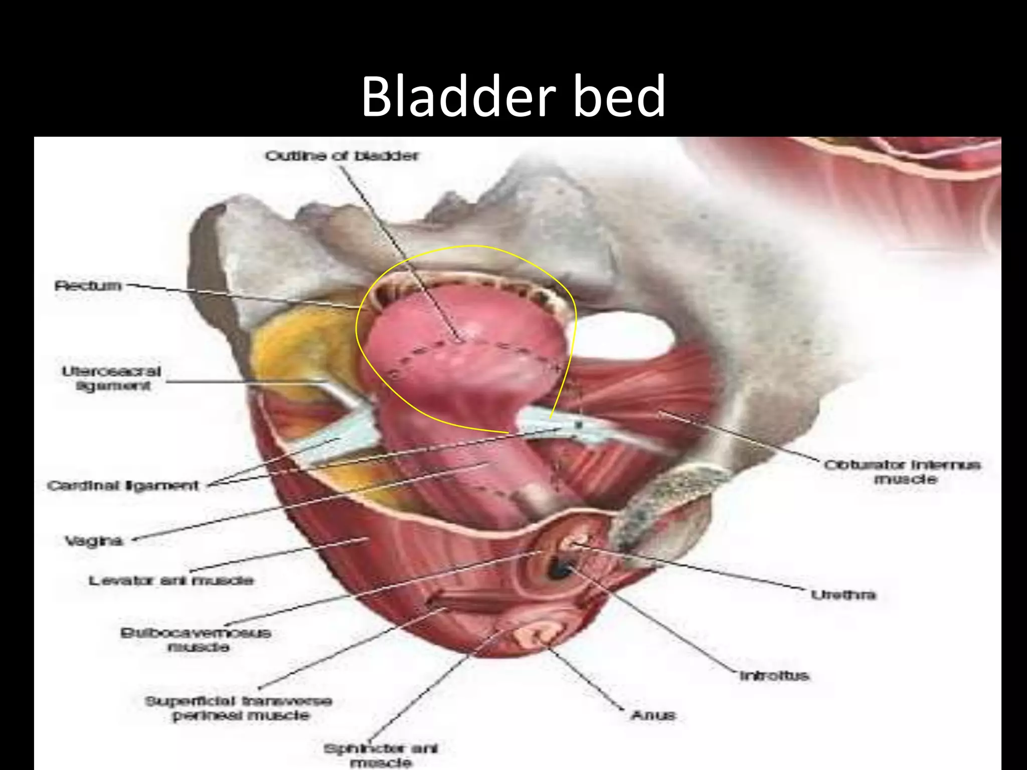Bladder bed
 