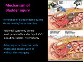 Mechanism of
  Bladder injury

Perforation of bladder dome during
Veress needle/trocar insertion

Incidental cystotomy during
development of bladder flap & VVS
 in routine/radical Hysterectomy

Adhesiolysis or dissection with
endoscopic scissors with or
without electrosurgery
 