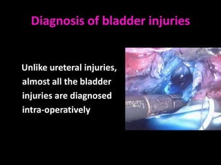 Diagnosis of bladder injuries


Unlike ureteral injuries,
almost all the bladder
injuries are diagnosed
intra-operatively
 