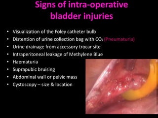 Signs of intra-operative
                  bladder injuries
•   Visualization of the Foley catheter bulb
•   Distention of urine collection bag with CO2 (Pneumaturia)
•   Urine drainage from accessory trocar site
•   Intraperitoneal leakage of Methylene Blue
•   Haematuria
•   Suprapubic bruising
•   Abdominal wall or pelvic mass
•   Cystoscopy – size & location
 