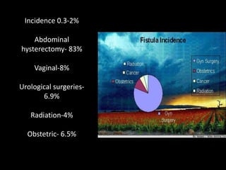 Incidence 0.3-2%

    Abdominal
hysterectomy- 83%

    Vaginal-8%

Urological surgeries-
       6.9%

   Radiation-4%

  Obstetric- 6.5%
 