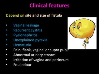 Clinical features
Depend on site and size of fistula

•   Vaginal leakage
•   Recurrent cystitis
•   Pyelonephritis
•   Unexplained pyrexia
•   Hematuria
•   Pain: flank, vaginal or supra pubic
•   Abnormal urinary stream
•   Irritation of vagina and perineum
•   Foul odour
 
