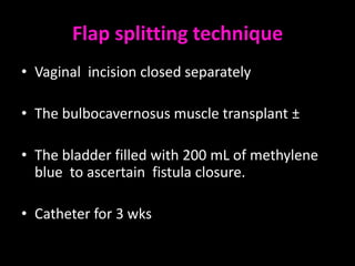 Flap splitting technique
• Vaginal incision closed separately

• The bulbocavernosus muscle transplant ±

• The bladder filled with 200 mL of methylene
  blue to ascertain fistula closure.

• Catheter for 3 wks
 