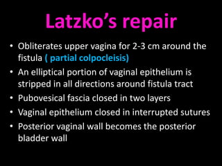 Latzko’s repair
• Obliterates upper vagina for 2-3 cm around the
  fistula ( partial colpocleisis)
• An elliptical portion of vaginal epithelium is
  stripped in all directions around fistula tract
• Pubovesical fascia closed in two layers
• Vaginal epithelium closed in interrupted sutures
• Posterior vaginal wall becomes the posterior
  bladder wall
 