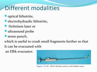 Different modalities
optical lithotrite,
electrohydraulic lithotrite,
 Holmium laser or
ultrasound probe
stone punch,
which is useful to crush small fragments further so that
It can be evacuated with
an Ellik evacuator.
 