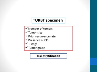  Number of tumors
 Tumor size
 Prior recurrence rate
 Presence of CIS
 T stage
 Tumor grade
TURBT specimen
Risk stratification
 