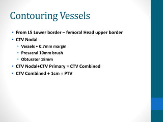 Contouring Vessels
• From L5 Lower border – femoral Head upper border
• CTV Nodal
• Vessels + 0.7mm margin
• Presacral 10mm brush
• Obturator 18mm
• CTV Nodal+CTV Primary = CTV Combined
• CTV Combined + 1cm = PTV
 