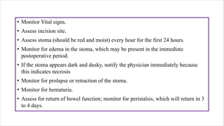 Bladder cancer | PDF