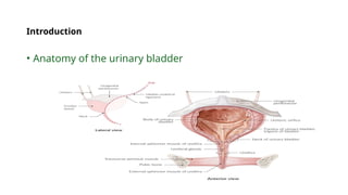 bladder cancer for nurses students presentation | PPTX