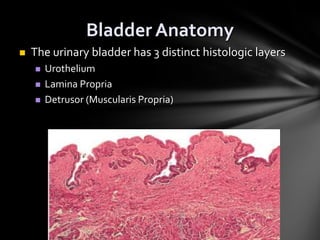 Bladder Cancer 7.ppt