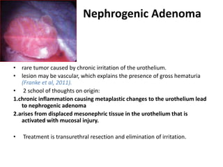 Nephrogenic Adenoma
•
• rare tumor caused by chronic irritation of the urothelium.
• lesion may be vascular, which explains the presence of gross hematuria
(Franke et al, 2011).
• 2 school of thoughts on origin:
1.chronic inflammation causing metaplastic changes to the urothelium lead
to nephrogenic adenoma
2.arises from displaced mesonephric tissue in the urothelium that is
activated with mucosal injury.
• Treatment is transurethral resection and elimination of irritation.
 