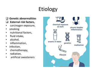 Etiology
 Genetic abnormalities
 External risk factors,
• carcinogen exposure,
• smoking
• nutritional factors,
• fluid intake,
• alcohol,
• inflammation,
• infection,
• chemotherapy,
• radiation,
• artificial sweeteners
 