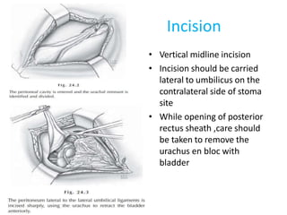 Incision
• Vertical midline incision
• Incision should be carried
lateral to umbilicus on the
contralateral side of stoma
site
• While opening of posterior
rectus sheath ,care should
be taken to remove the
urachus en bloc with
bladder
 