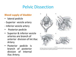 Pelvic Dissection
Blood supply of bladder
• lateral pedicle
- Superior vesicle artery
- Inferior vesicle artery
• Posterior pedicle
• Superior & inferior vesicle
arteries are branch of
anterior division of Int iliac
Artery.
• Posterior pedicle is
branch of posterior
division of Internal
iliac Artery.
 