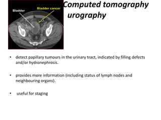 Computed tomography
. urography
• detect papillary tumours in the urinary tract, indicated by filling defects
and/or hydronephrosis.
• provides more information (including status of lymph nodes and
neighbouring organs).
• useful for staging
 