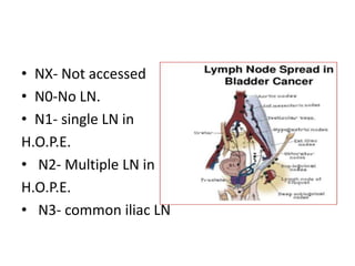 • NX- Not accessed
• N0-No LN.
• N1- single LN in
H.O.P.E.
• N2- Multiple LN in
H.O.P.E.
• N3- common iliac LN
 