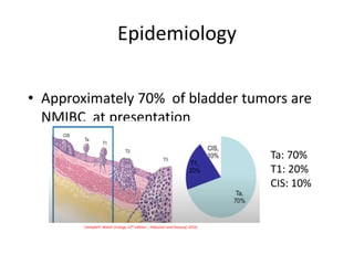 Epidemiology
• Approximately 70% of bladder tumors are
NMIBC at presentation
Campbell- Walsh Urology 12th edition ; Aldousari and Kassouf, 2010;
Ta: 70%
T1: 20%
CIS: 10%
 