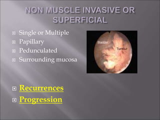  Single or Multiple
 Papillary
 Pedunculated
 Surrounding mucosa
 Recurrences
 Progression
 