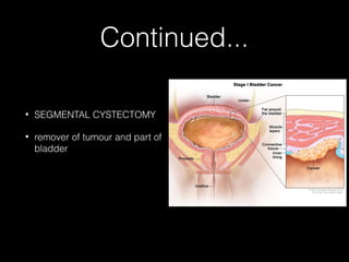 Continued...
•

SEGMENTAL CYSTECTOMY

•

remover of tumour and part of
bladder

 