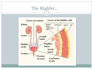 The Bladder…