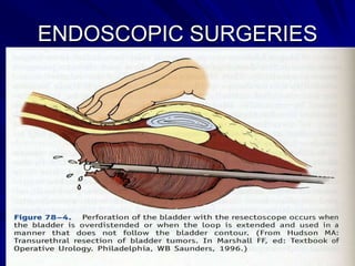 ENDOSCOPIC SURGERIES

 