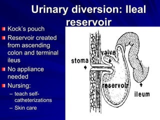 Urinary diversion: Ileal
reservoir
Kock’s pouch
Reservoir created
from ascending
colon and terminal
ileus
No appliance
needed
Nursing:
– teach selfcatheterizations
– Skin care

 