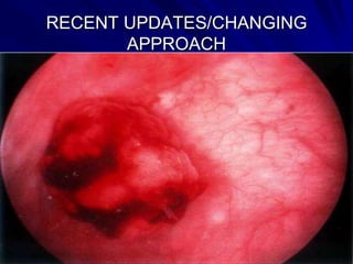 RECENT UPDATES/CHANGING
APPROACH

 