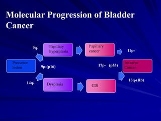 Molecular Progression of Bladder
Cancer
9q-

Precursor
lesion

14q-

Papillary
hyperplasia

Papillary
cancer

17p- (p53)

9p-(p16)

11pInvasive
Cancer
13q-(Rb)

Dysplasia

CIS

 