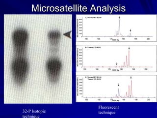 Microsatellite Analysis

32-P Isotopic
technique

Fluorescent
technique

 