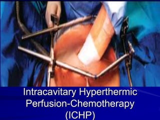 Intracavitary Hyperthermic
Perfusion-Chemotherapy
(ICHP)

 
