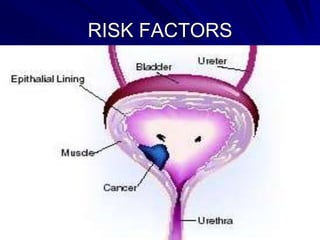 RISK FACTORS

 