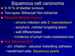 Squamous cell carcinoma
5-10 % of bladder tumours
Two types- Bilharzial/ Non-bilharzial
Bilharzial Bladder Cancer
- chronic infection with S. haematobium
- exophytic ,nodular fungating lesion
- well differentiated
- incidence of lymph node,metastasis-low
Non Bilharzial SCC
- chr. irritation- calculus/ indwelling catheters
- keratinized cells- Squamous pearls

 