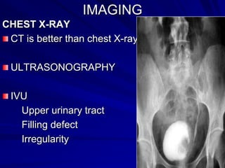 IMAGING
CHEST X-RAY
CT is better than chest X-ray
ULTRASONOGRAPHY

IVU
Upper urinary tract
Filling defect
Irregularity

 