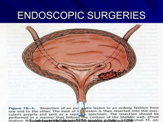 ENDOSCOPIC SURGERIES

 