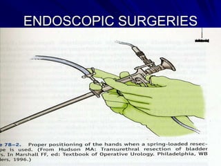 ENDOSCOPIC SURGERIES

 