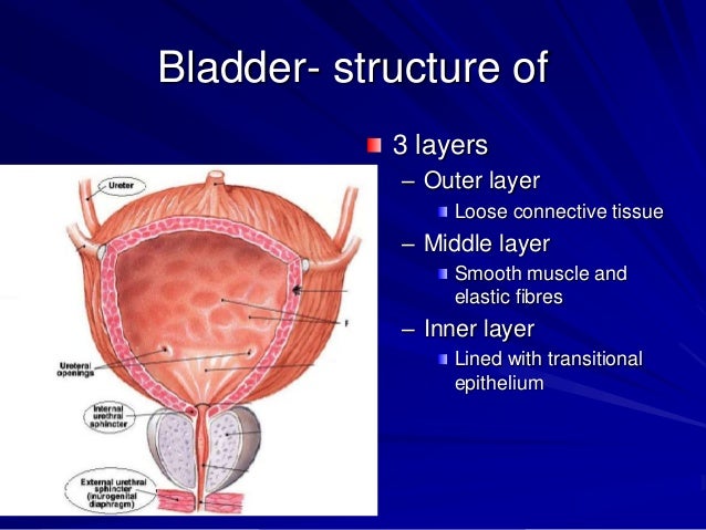 Bladder carcinoma