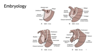Bladder Extrophy and Epispadias Complex BEEC - Dr. ESIRU-2.pptx