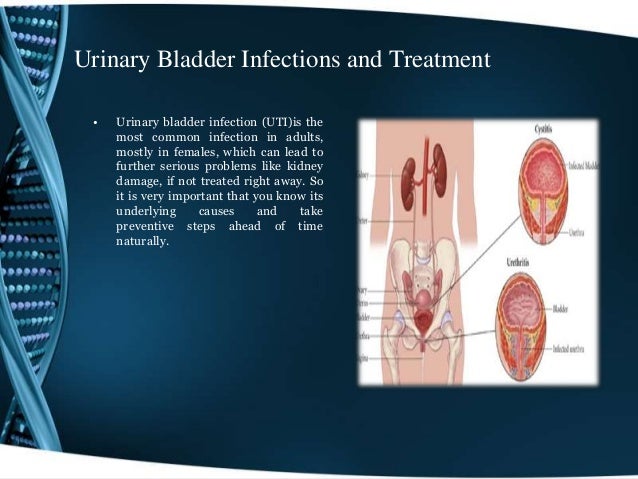 bladder infection treatment bladder infection treatment bladder infection treatment bladder infection treatment