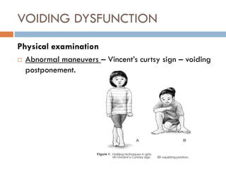 VOIDING DYSFUNCTION
Physical examination
 Abnormal maneuvers – Vincent’s curtsy sign – voiding
postponement.
 