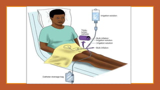 Bladder irrigation | PPTX