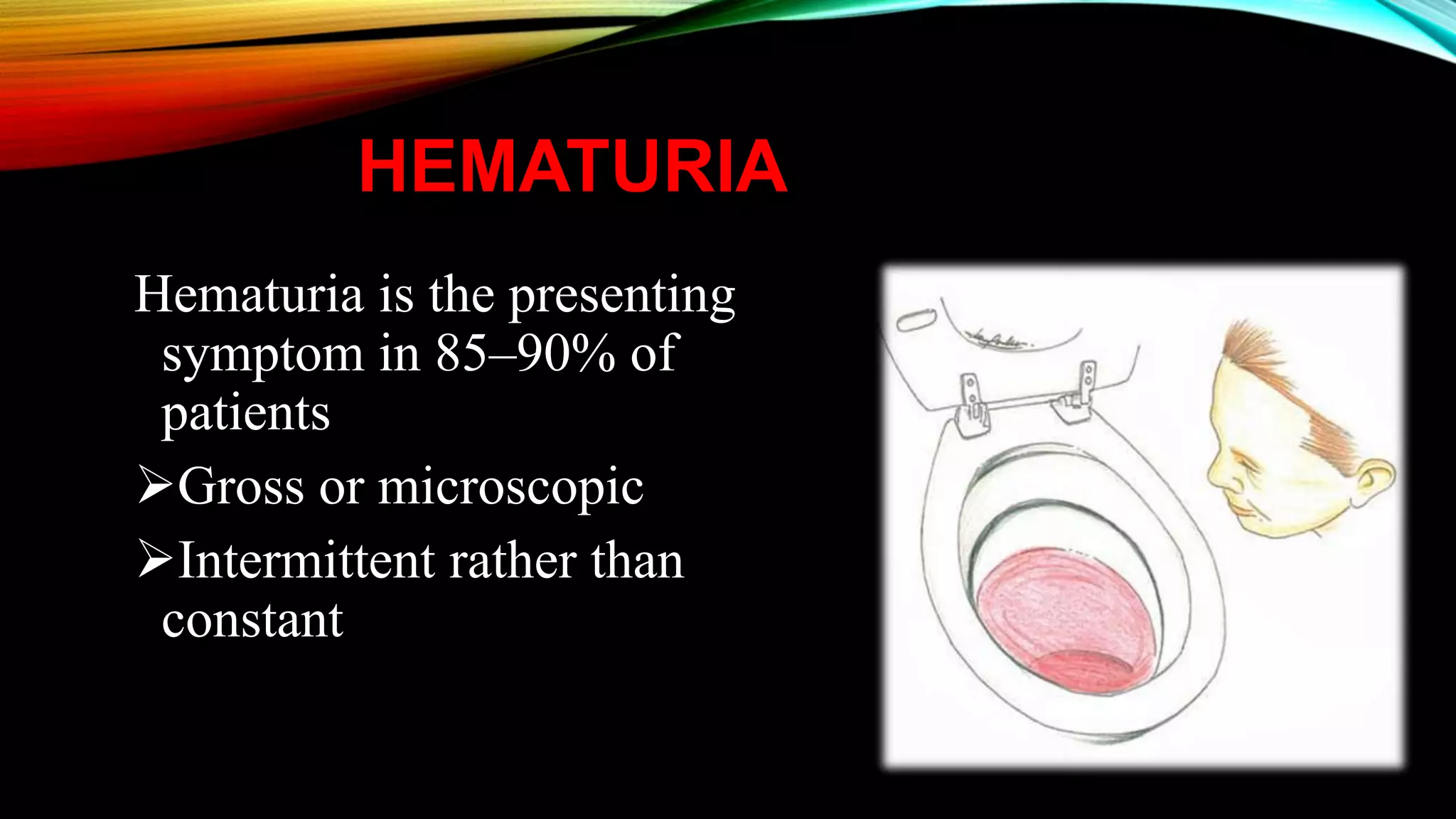 HEMATURIA
Hematuria is the presenting
symptom in 85–90% of
patients
Gross or microscopic
Intermittent rather than
constant
 