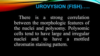UROVYSION (FISH)…..
There is a strong correlation
between the morphologic features of
the nuclei and polysomy. Polysomic
cells tend to have large and irregular
nuclei and to have a mottled
chromatin staining pattern.
 