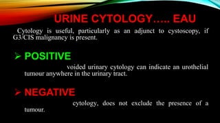 URINE CYTOLOGY….. EAU
Cytology is useful, particularly as an adjunct to cystoscopy, if
G3/CIS malignancy is present.
 POSITIVE
voided urinary cytology can indicate an urothelial
tumour anywhere in the urinary tract.
 NEGATIVE
cytology, does not exclude the presence of a
tumour.
 
