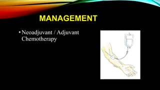 MANAGEMENT
•Neoadjuvant / Adjuvant
Chemotherapy
 