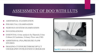 Luts Boo BLADDER OUTFLOW OBSTRUCTION(BOO) PPT.pptx