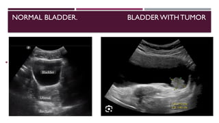 Gross Normal Bladder Urinary Bladder presentation_ 12345_ppt_ | PPTX